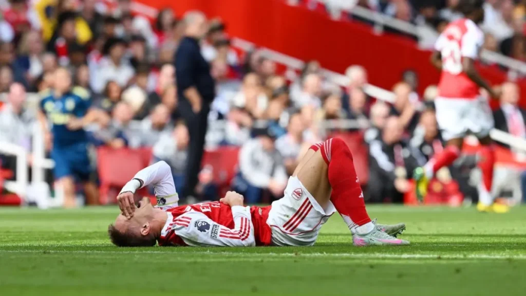 Arteta Updates on Ødegaard’s Injury and His Champions League Prospects