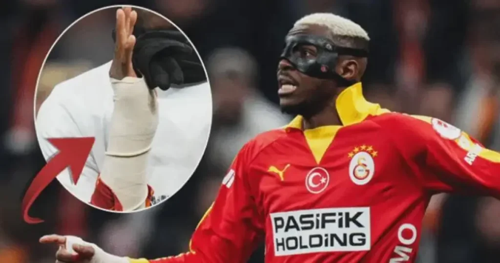 ഗലതസറെ താരം വിക്ടർ ഒസിമെൻ അണിഞ്ഞ പ്രൊട്ടക്റ്റീവ് കാസ്റ്റിനെതിരെ തുർക്കിഷ് ഫെഡറേഷനിൽ പരാതി നൽകി ഫെനർബാച്ചെ